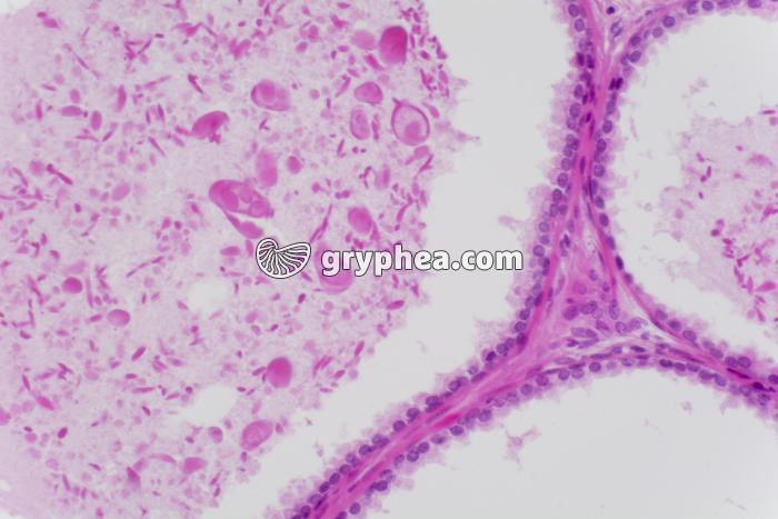 Prostate x100 - gryphea.org